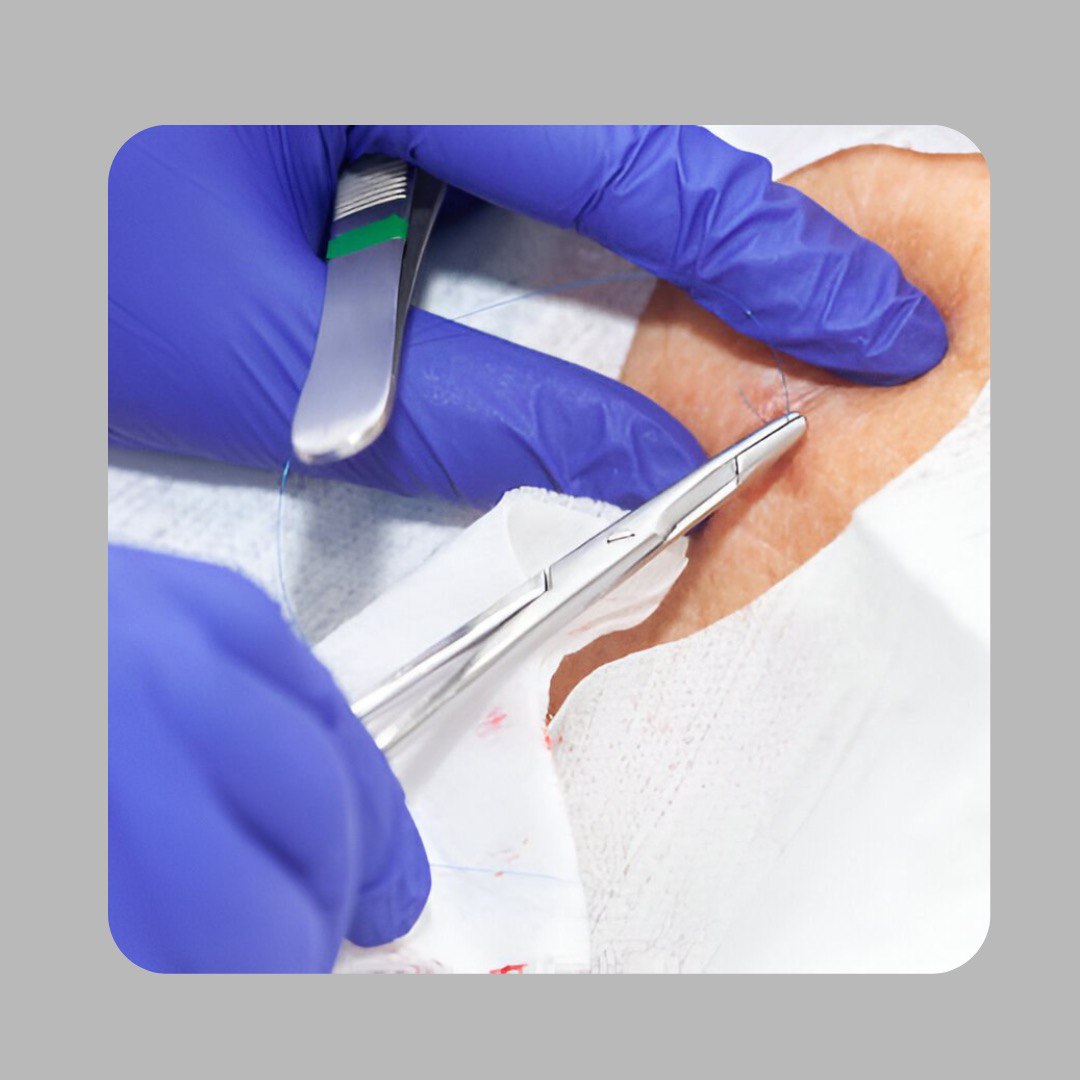 course :Skin Biopsy Techniques